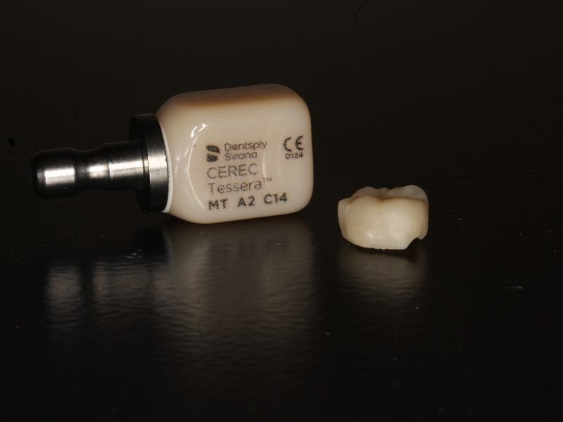 A dental prosthetic created in-house by the new milling machine at the WSU dental clinic.